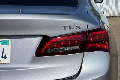2015 Acura TLX V6 Tech